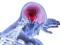 Вчені зі США виявили, що клітини імунної системи атакують мозок після травми голови