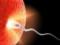 Ученые обнаружили ген, связанный с мужским бесплодием
