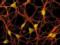Ученые раскрыли механизм  живучести  нейронов