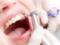 Профессиональная чистка зубов: есть ли в ней необходимость?