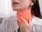 British doctor calls morning sore throat a sign of cancer