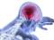 Вчені зі США виявили, що клітини імунної системи атакують мозок після травми голови