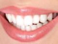 Ученые: новый метод заставит зубы расти снова