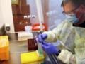 Антитела после COVID могут атаковать организм