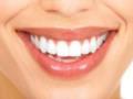 Секреты голливудской улыбки: рекомендации для поддержания здоровья зубов