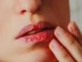 Сухі губи: ефективні методи лікування в домашніх умовах