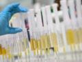 Верховная Рада усилила криминальную ответственность за применение допинга