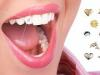 Стильные украшения для зубов: новый тренд в стоматологии