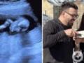 Украинские фотографы Либеровы впервые станут родителями: супруги показали очень трогательное гендер-пати.
