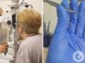 Жаловалась на слабость и отеки: на Ривненщине из глаза у женщины достали 11-сантиметрового гельминта.