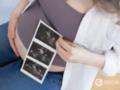 ЭКО за государственный счет: революционные возможности лечения бесплодия в Украине