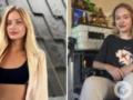  Узнали?  Покалеченная в Дубае Мария Ковальчук вернулась в соцсети и показала, как живет через 7 месяцев после трагедии