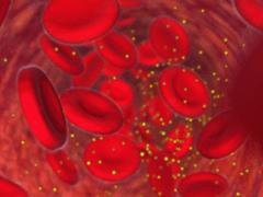 On the analysis of blood it will be possible to detect lung cancer at an early stage of development