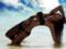 Contusion of the tailbone can have serious consequences
