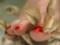 Dangerous procedure: a woman after a pedicure has lost her nails