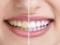 Четыре привычки, от которых желтеют зубы