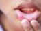 Scientists talked about the signs of diseases visible in the mouth