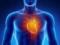 Учёные назвали неожиданные симптомы сердечного приступа