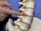 Intervertebral hernia: effective treatment without surgery