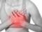 5 неявных симптомов сердечного приступа: что упускают из виду