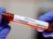 Ученые пригрозили британским властям миллионами зараженных коронавирусом