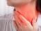 Біль в горлі: як відрізнити вірусну інфекцію від серцевого нападу