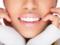 11 лёгких способов отбелить зубы в домашних условиях
