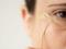 Морщины вокруг глаз в молодом возрасте: как их избежать