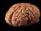 Ученые нашли новый способ обнаружения быстрорастущей формы рака мозга