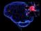 Ученые выделили клетки мозга, наиболее подверженные эпилепсии