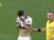 Пошкодив яєчко: у Бразилії футболіст отримав незвичайну травму під час матчу