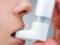 Лекарства от астмы связали с преждевременными родами
