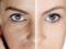 Як звузити пори на обличчі будинку: золоті правила догляду за шкірою