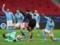 Манчестер Сити — Боруссия М 2:0 Видео голов и обзор матча