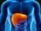 Unusual symptom of liver cancer named