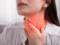 Боль в горле: в каких случаях нужно бить тревогу