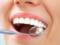 Хвороби можна визначити за кількістю зубів