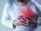 Кардиолог назвал ранние симптомы инфаркта