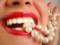 Лазерне відбілювання зубів: особливості та переваги
