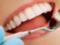 Like ailments, you can provoke an incorrect look at your teeth with an empty mouth?