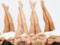 Hair diseases and medical cosmetics: excessive hair growth