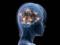 Human brain looks years older after one night without sleep - study