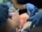 Дитині вперше в Україні пересадили шкіру від посмертного донора