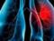 It is possible to diagnose cancer with nails