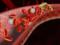 5 sign of parasites in the body