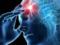 Prevention of micro-stroke: key entry to intimidate a serious state