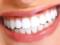 Как поддержать белизну зубов дома: эффективные методы