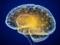Brain implant: Improving health in the fight against epilepsy and OCD