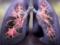 Increased risk of cancer when switching from cigarettes to vapes: new research